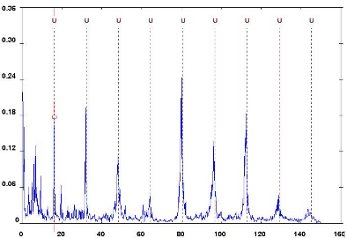 Maschinenvibrationsspektrumanalyse - Entdeckung von Fehlern (5) - Schwingungsspektrum bei Zahnfehler (Quelle: DDC)