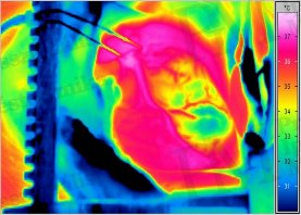 Termográfia - szakmai képzés nélkül - Szív artéria-elzárodással (forrás: Infratec)